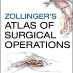 Zollinger's Atlas of Surgical Operations, 9th Edition