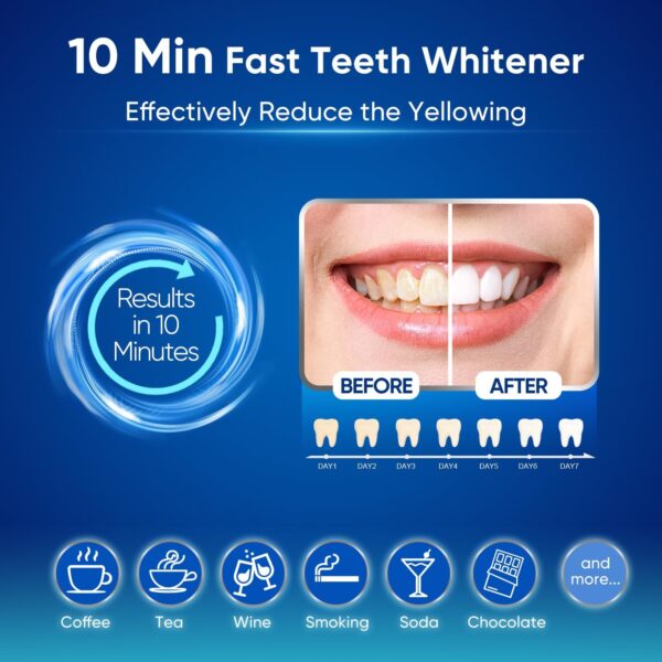 MySmile Teeth Whitening Kit for Sensitive Teeth with LED Light, 10 Min Non-Sensitive Fast Teeth Whitener, 6 Carbamide Peroxide Teeth Whitening Gel, Powerful whitening Formula, Enamel Safe (B Blue)