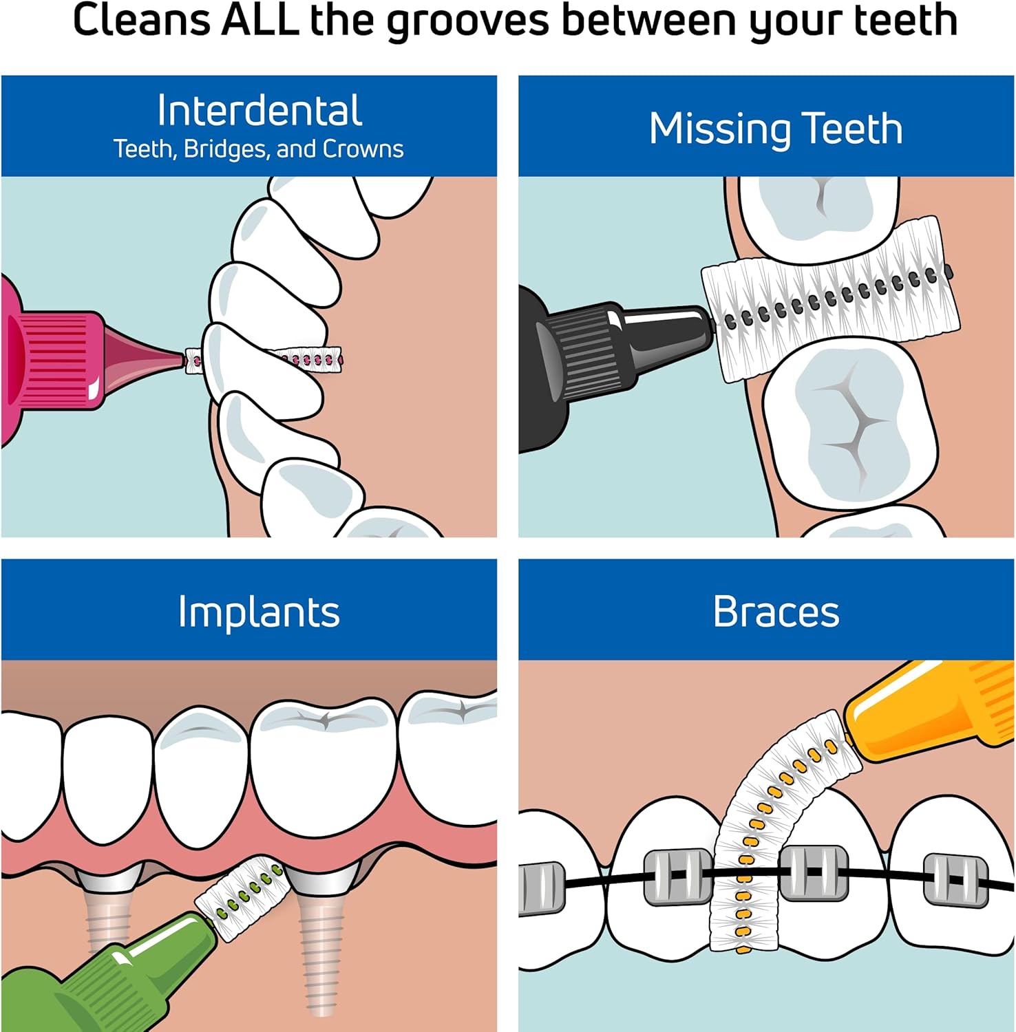 TePe Interdental Brush Original, Soft Dental Brush for Teeth Cleaning, Pack of 6, 0.8mm, Large Gaps, Green, Size 5 - Image 3