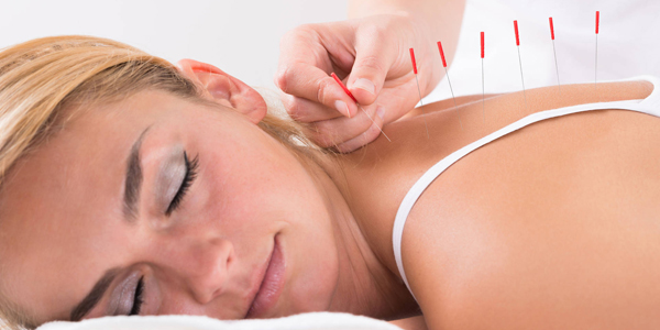Acupuncture