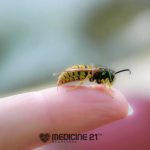 Insect stings – infographic