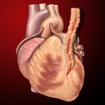 Coronary artery bypass graft