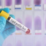 Cholesterol and lipid tests