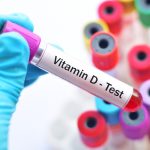 Vitamin D test