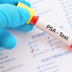 Prostate specific antigen (PSA) test