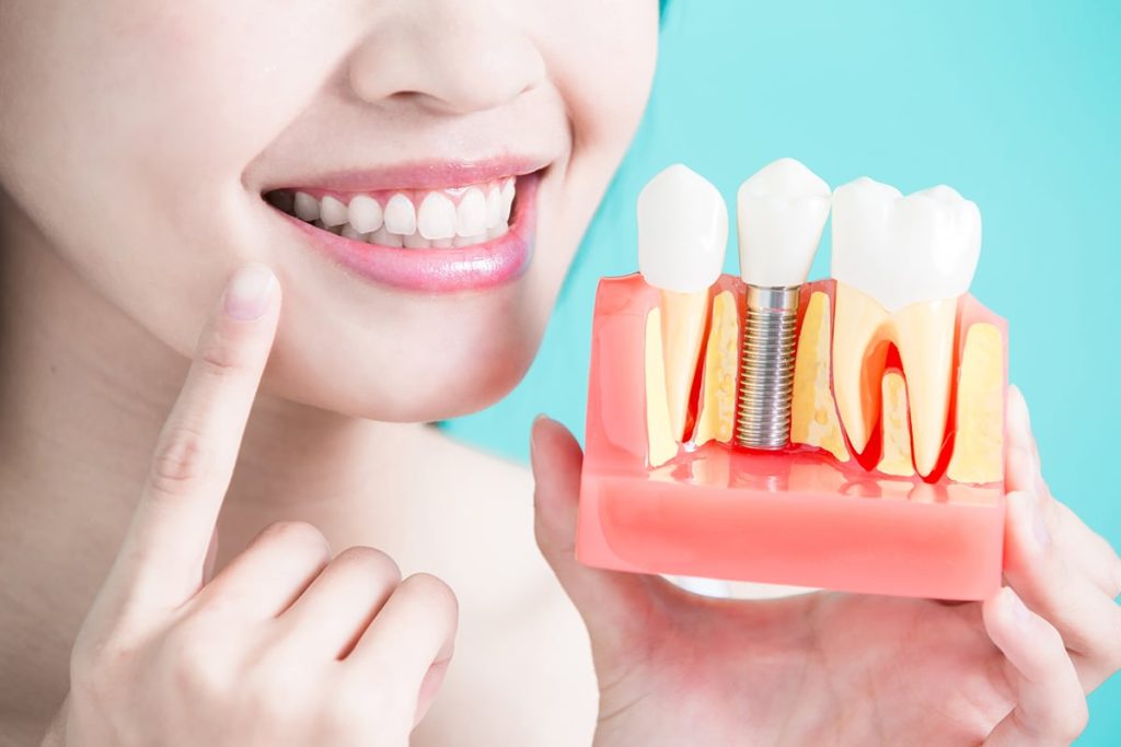 Dental implant procedure