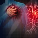 Acute coronary syndrome