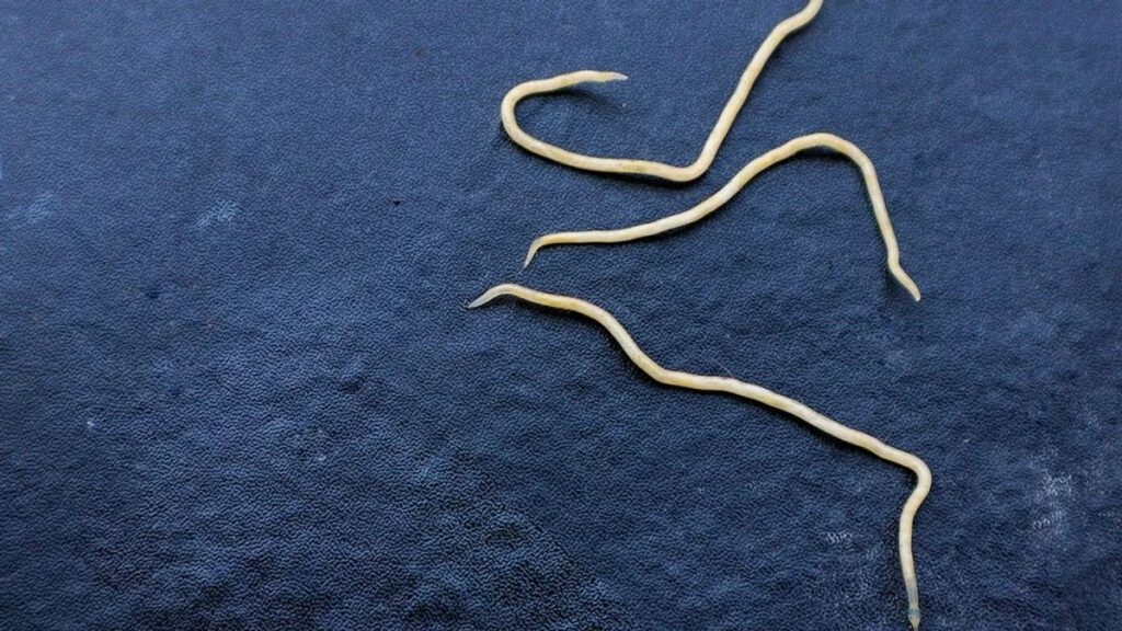 Threadworms (pinworms)