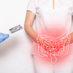 Ulcerative colitis