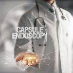 Capsule endoscopy
