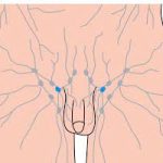 Penile dynamic sentinel lymph node biopsy