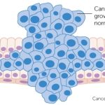 Cancer grows as cells multiply over and over