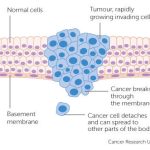 How cancer can spread