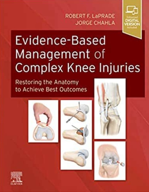 Evidence-Based Management of Complex Knee Injuries. Restoring the Anatomy to Achieve Best Outcomes (LaPrade) 1 ed (2020)