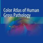 Color Atlas of Human Gross Pathology (Dawood) 1 ed (2022)