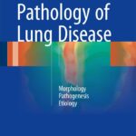 Pathology of Lung Disease Morphology – Pathogenesis – Etiology (Popper) 2 ed (2021)