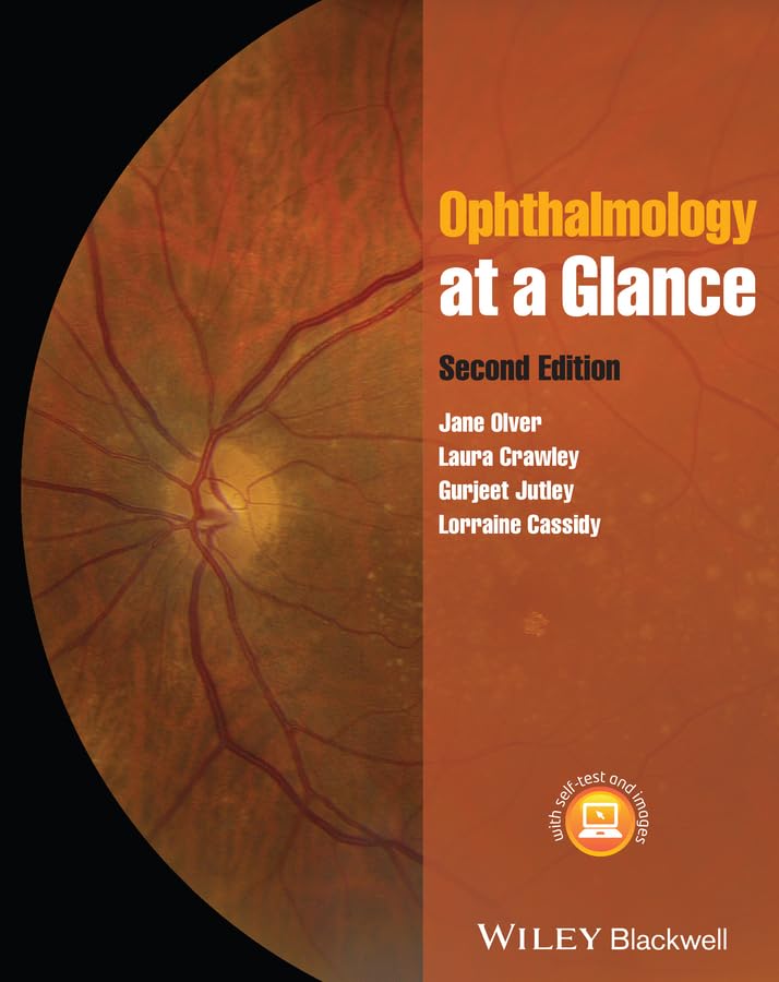 Ophthalmology (Olver) 2nd edition (2014)