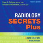 Radiology Secrets Plus (Torigian) 4th edition (2016)