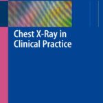 Chest X-Ray in Clinical Practice (Joarder) 1st edition (2009)