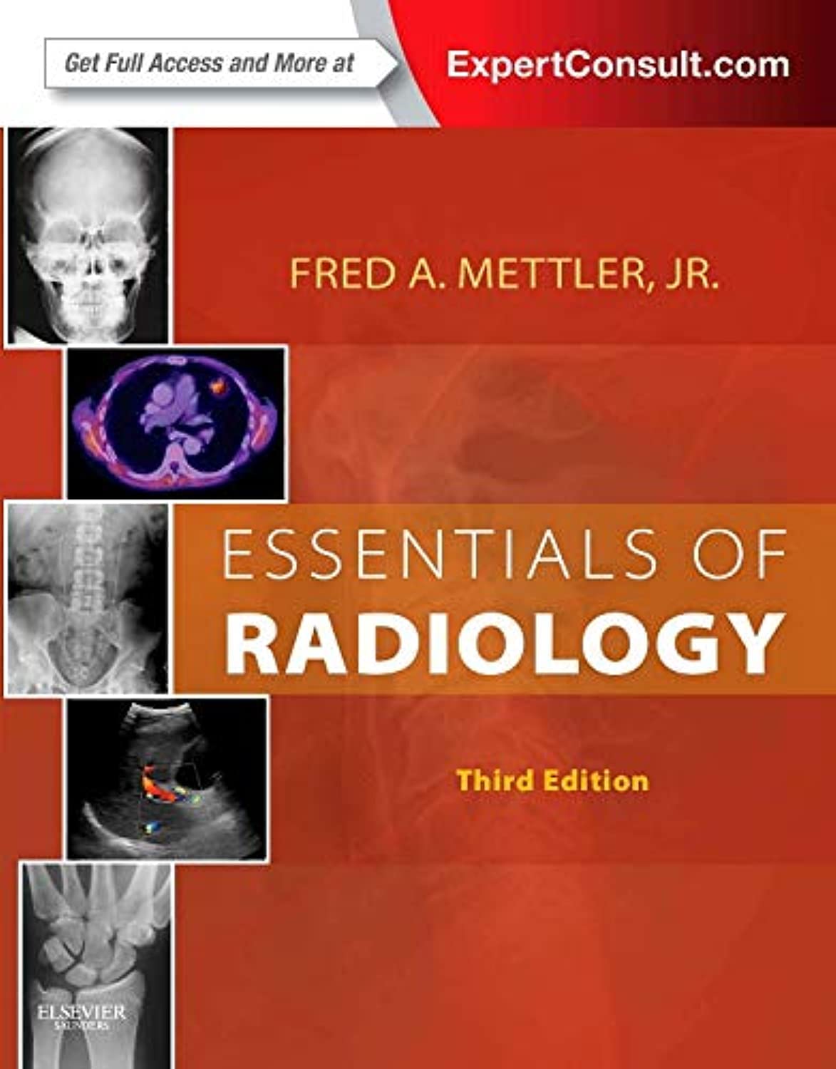 Essential of Radiology (Mettler) 3rd edition (2014) – Common Indications and Interpretation