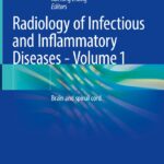 Radiology of Infectious and Inflammatory Diseases:  Volume 1 – Brain and Spinal Cord (Li) 1st edition (2023)