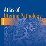 Atlas of Uterine Pathology (Fadare) 1 ed (2019)