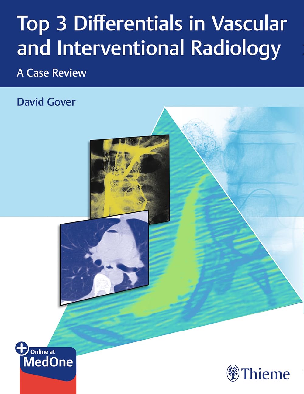 Top 3 Differentials in Vascular and lnterventional Radiology. A Case Review (Gover) 1st edition (2019)