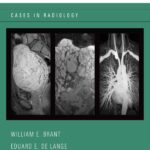 Body MRI Cases Cases in Radiology (Brant) 1st edition (2013)