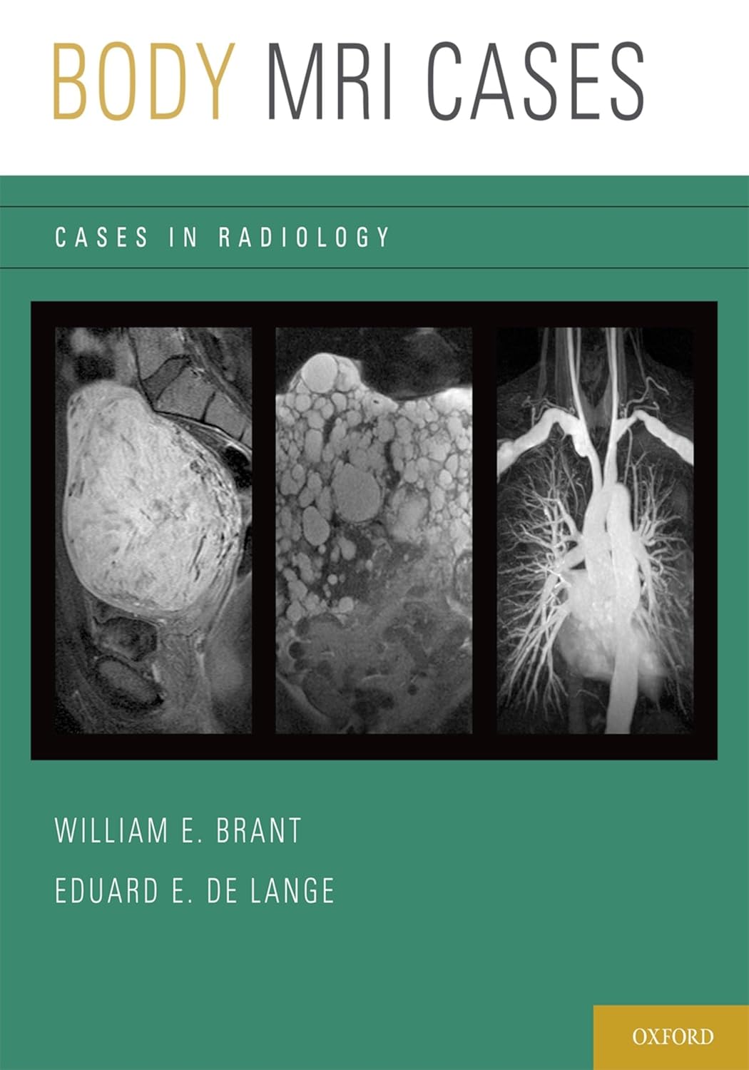 Body MRI Cases Cases in Radiology (Brant) 1st edition (2013)