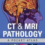 CT & MRI Pathology. A Pocket Atlas (Grey) 3 ed (2018)