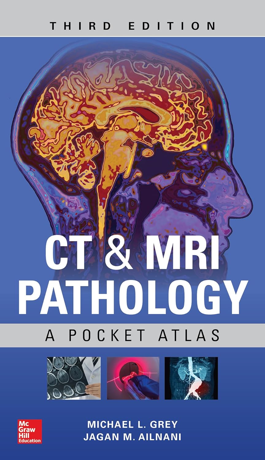 CT & MRI Pathology. A Pocket Atlas (Grey) 3 ed (2018)