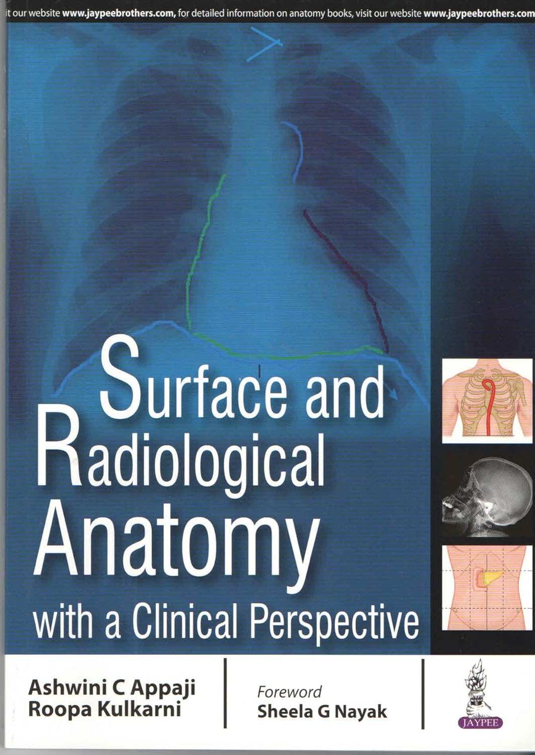 Surface and Radiological Anatomy with a Clinical Perspective (Appaji) 1st edition (2017)