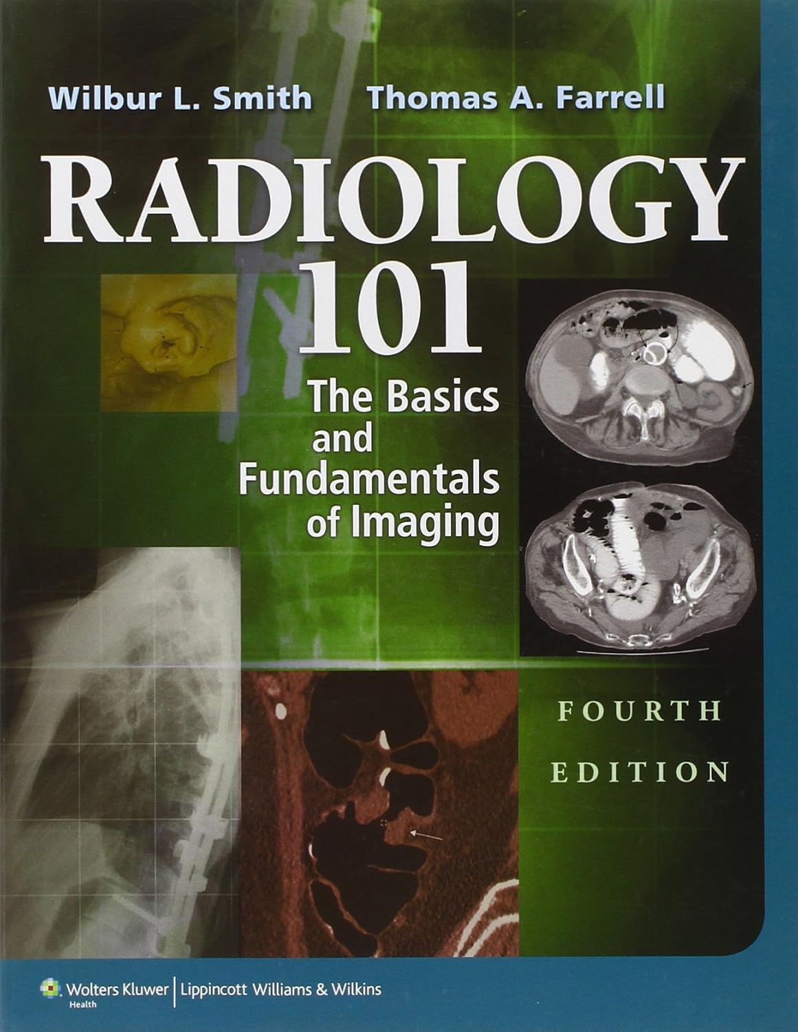 Radiology 101. The Basics & Fundamentals of Imaging (Smith) 4th edition (2013)