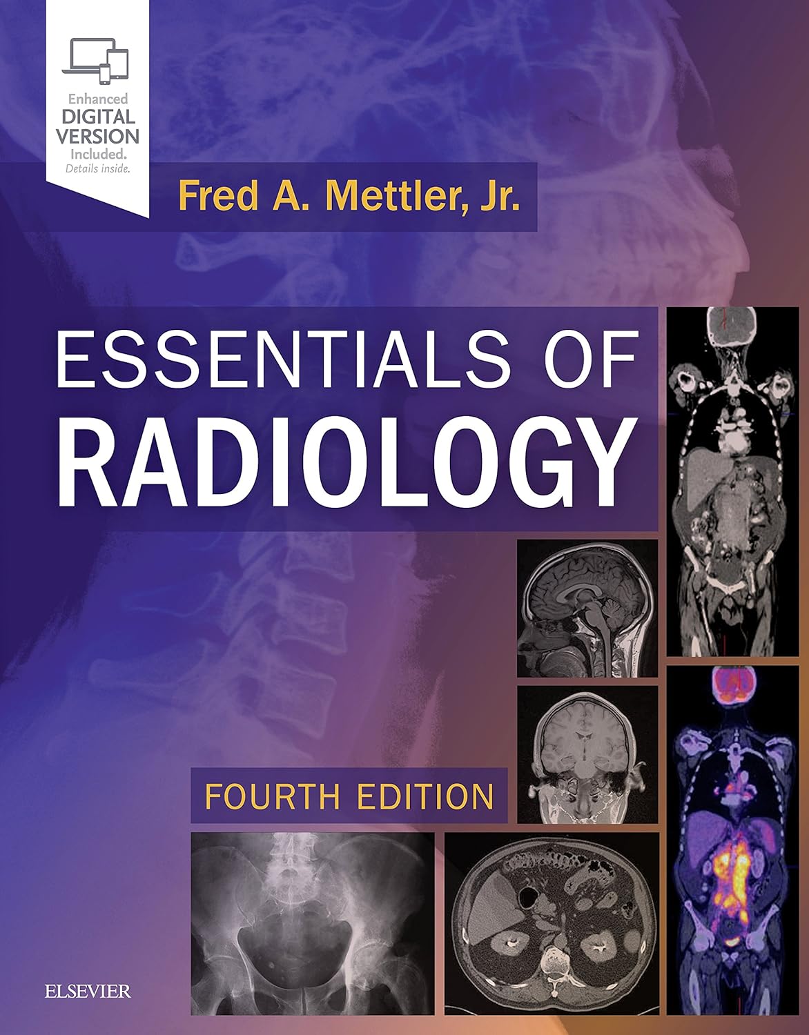 Essential of Radiology (Mettler) 4th edition (2019)