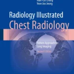 Radiology Illustrated. Chest Radiology. Pattern Approach for Lung Imaging (Lee) 2nd edition (2024)