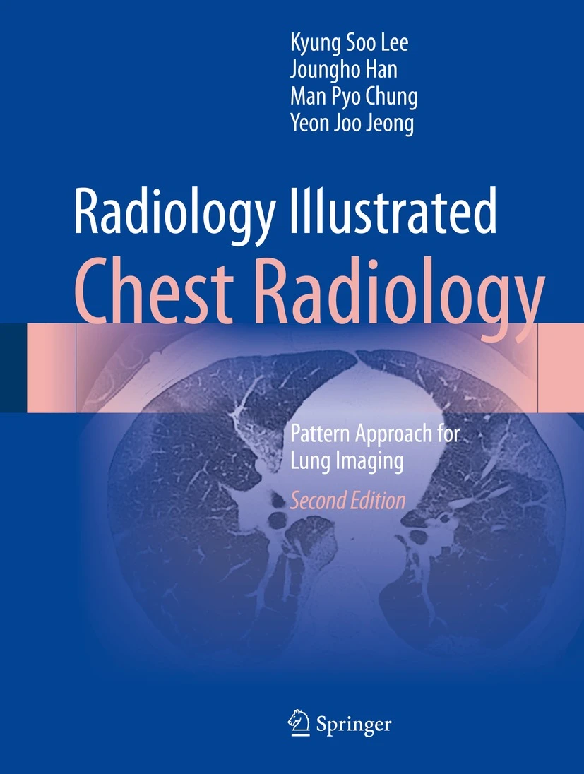 Radiology Illustrated. Chest Radiology. Pattern Approach for Lung Imaging (Lee) 2nd edition (2024)