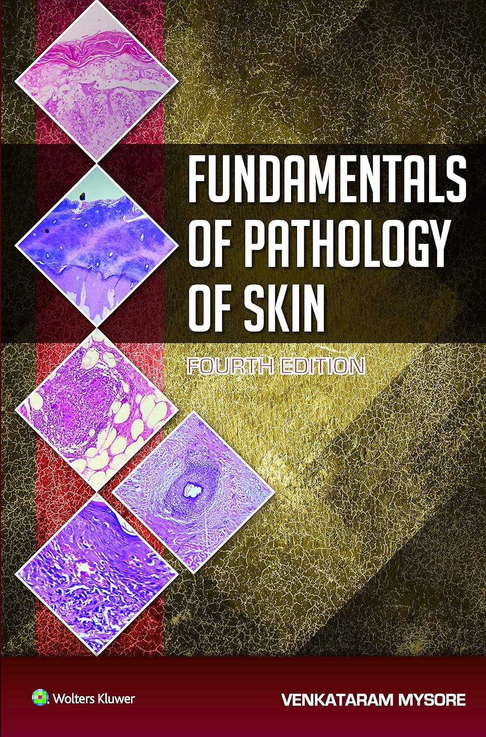 Fundamentals of Pathology of Skin (Mysore) 4 ed (2015)