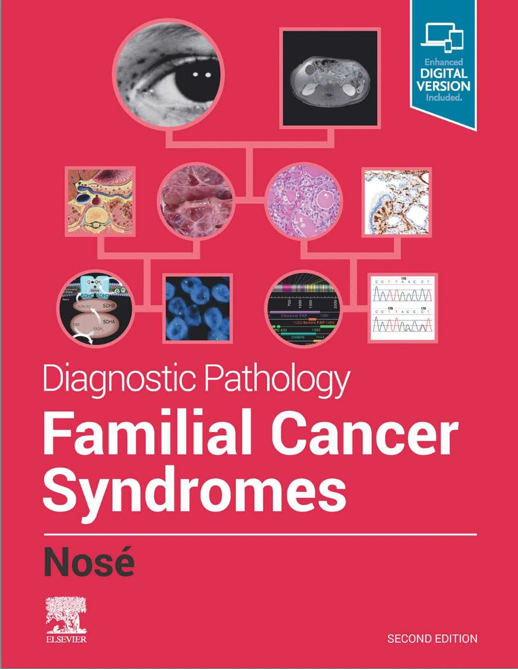 Diagnostic Pathology: Familial Cancer Syndromes (Nose) 2nd edition (2020)