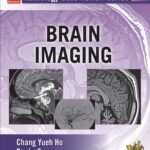 Radiology Case Review Series. Brain Images (Ho) 1st edition (2014)