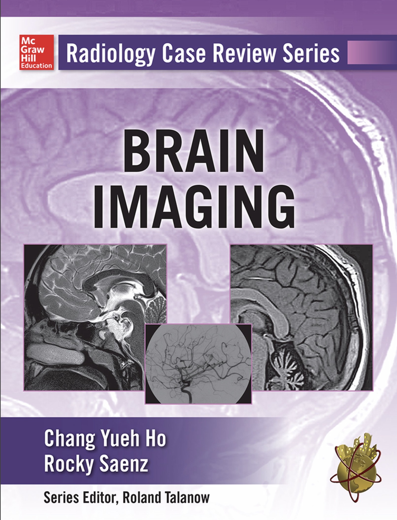 Radiology Case Review Series. Brain Images (Ho) 1st edition (2014)