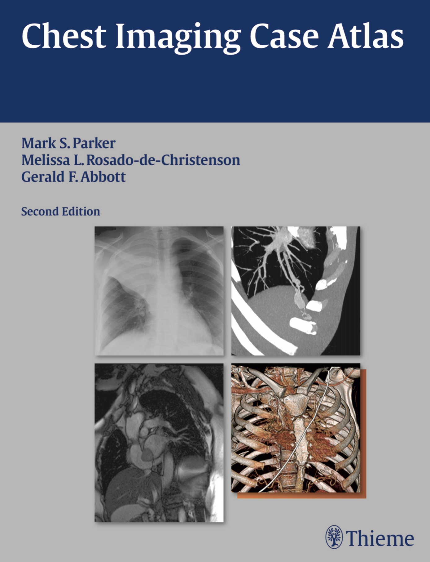 Chest Imaging Case Atlas (Parker) 2nd edition (2012)