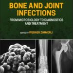 Bone and Joint Infections. From Microbiology to Diagnostics (Zimmerly) 2 ed (2021)