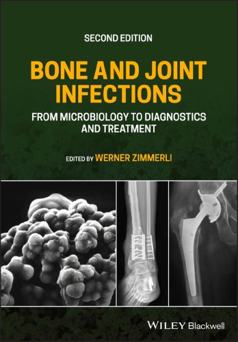 Bone and Joint Infections. From Microbiology to Diagnostics (Zimmerly) 2 ed (2021)