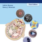 Neuro-Ophthalmology Illustrated (Biousse) 3rd edition (2020)