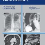 Radiology of Chest Diseases (Lange) 3rd edition (2007)