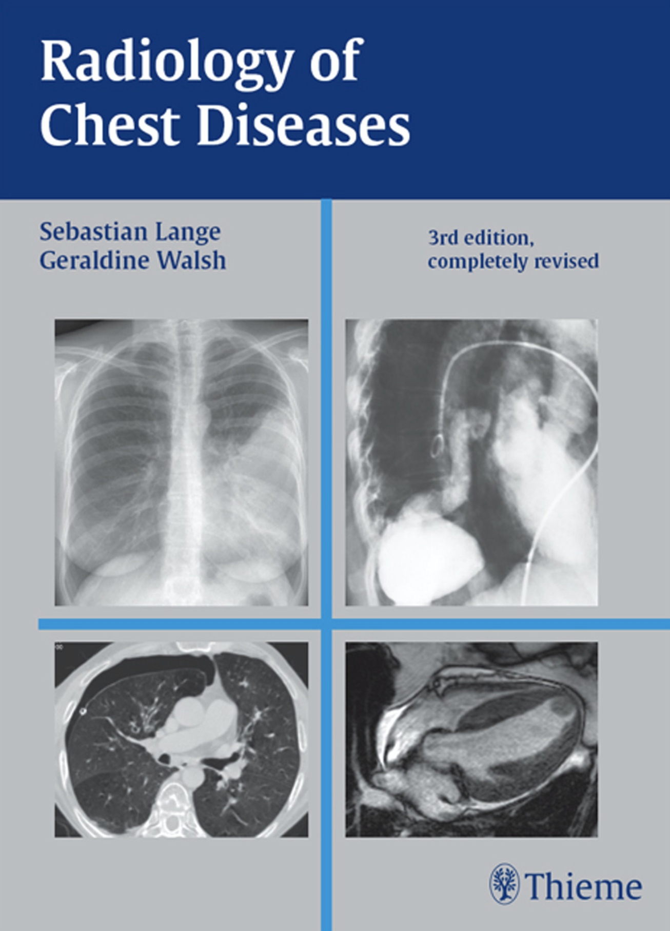 Radiology of Chest Diseases (Lange) 3rd edition (2007)