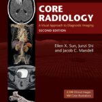 Core Radiology. A Visual Approach to Diagnostic Imaging (Sun) 2nd edition (2021)