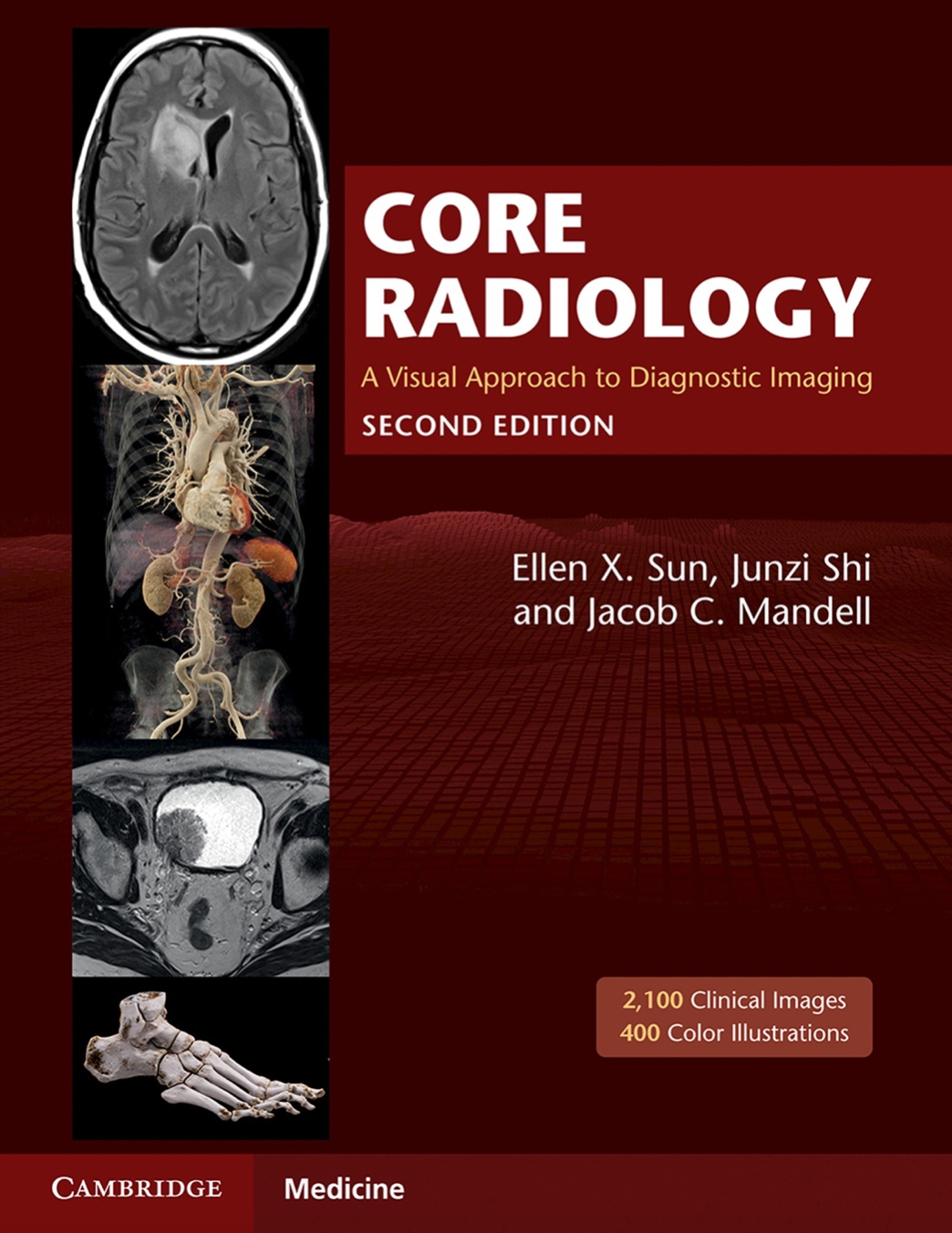 Core Radiology. A Visual Approach to Diagnostic Imaging (Sun) 2nd edition (2021)