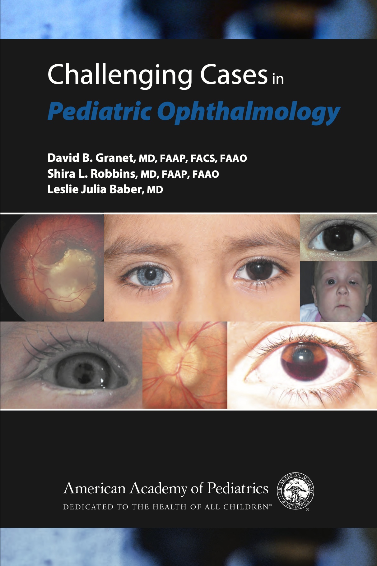 Challenging Cases in Pediatric Ophthalmology (Granet) 1st edition (2013)