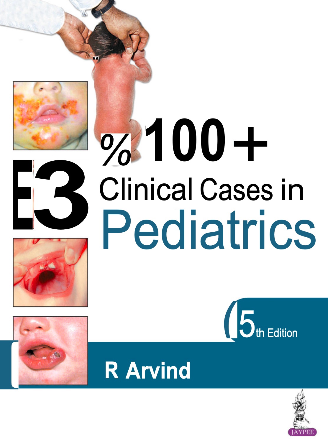 100+ Clinical Cases in Pediatrics (Arvind) 5th edition (2021)